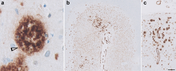 Fig. 1