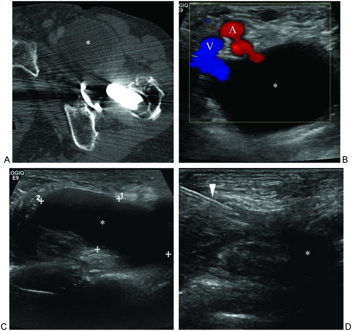 Figure 15