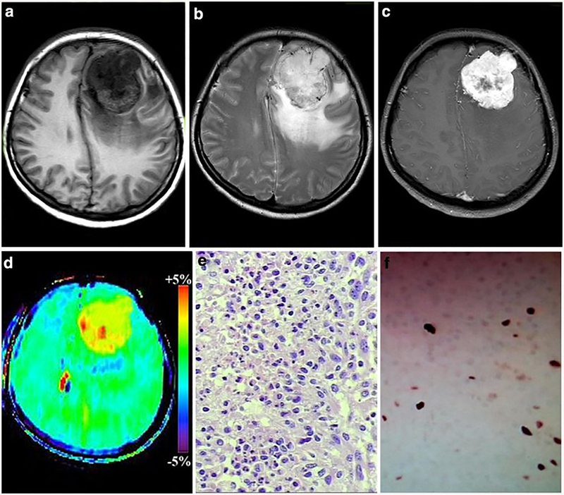 Fig. 4: