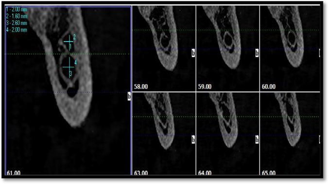 Fig. 6