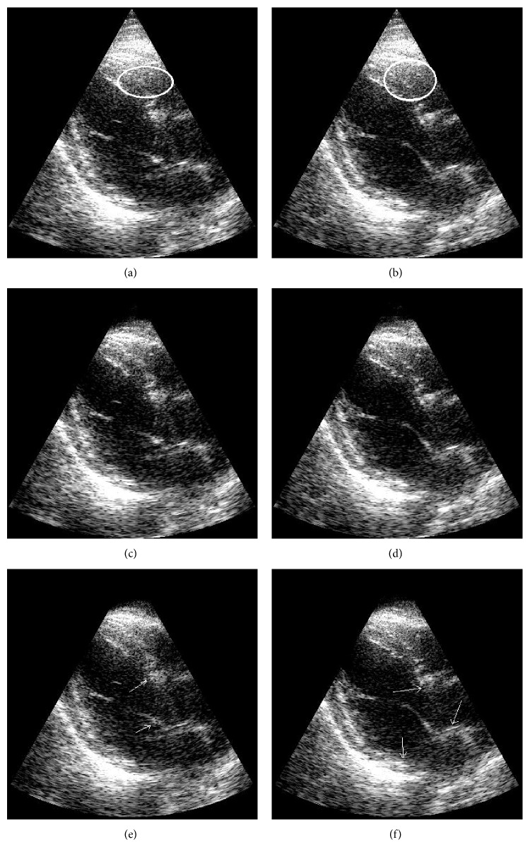 Figure 12