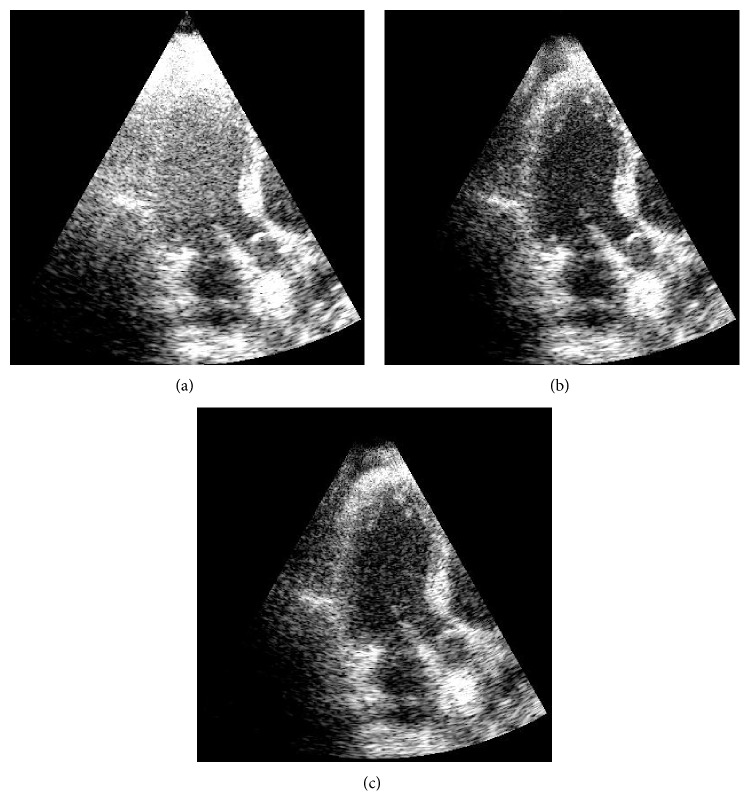 Figure 14