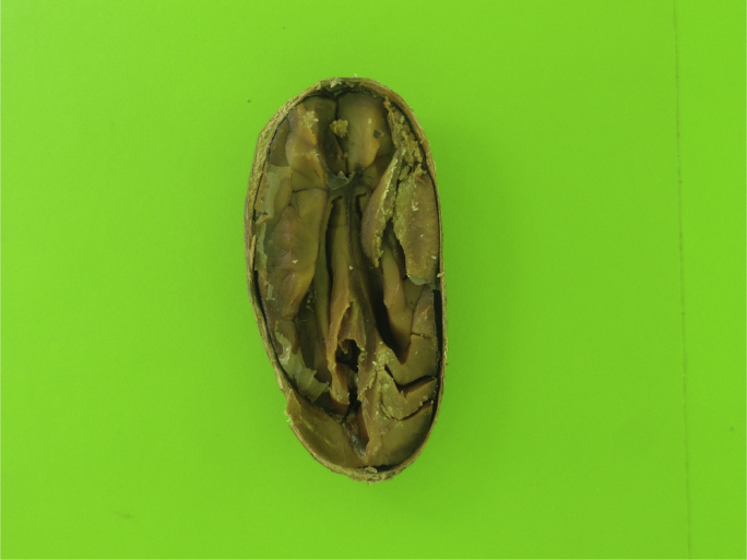 Fig. 1
