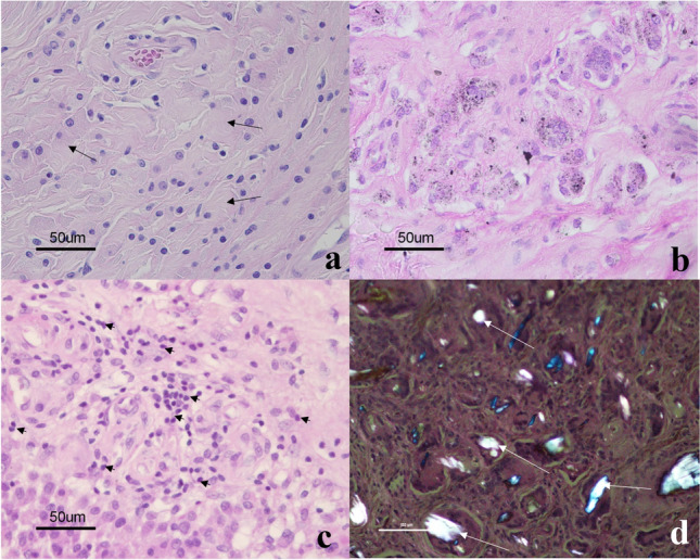 Fig. 11