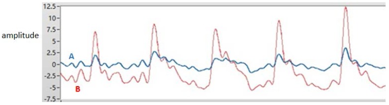 Figure 11