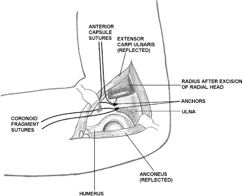 Figure 2