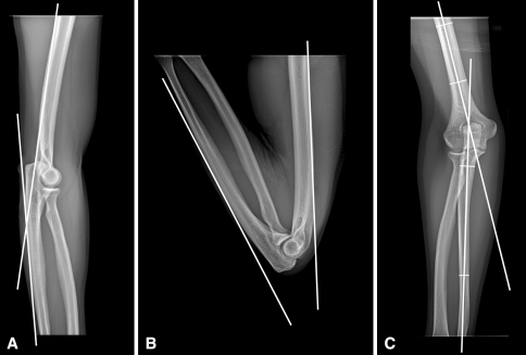 Fig. 2A–C