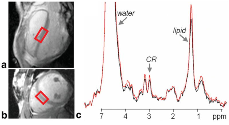 FIG. 5