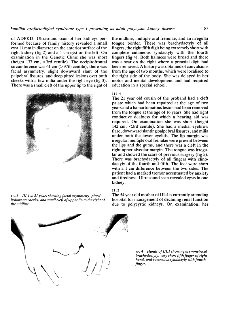 85