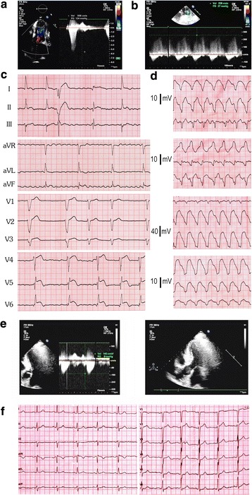 Fig. 1