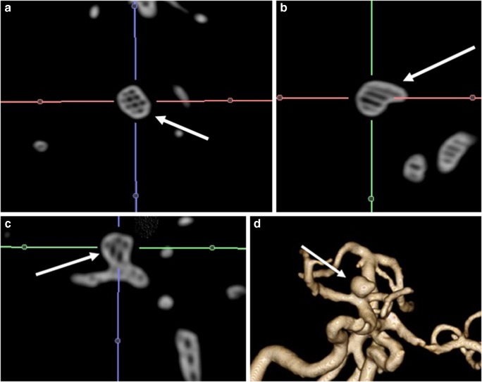 Fig. 4