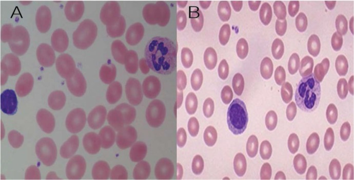 Figure 2A & B: