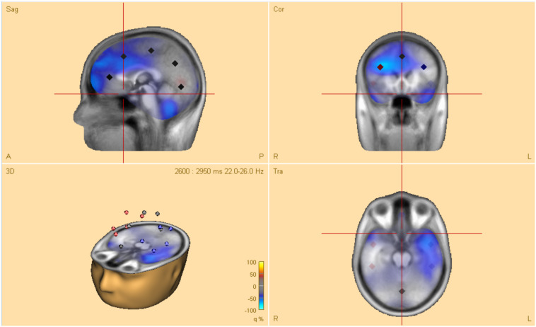 FIGURE 2