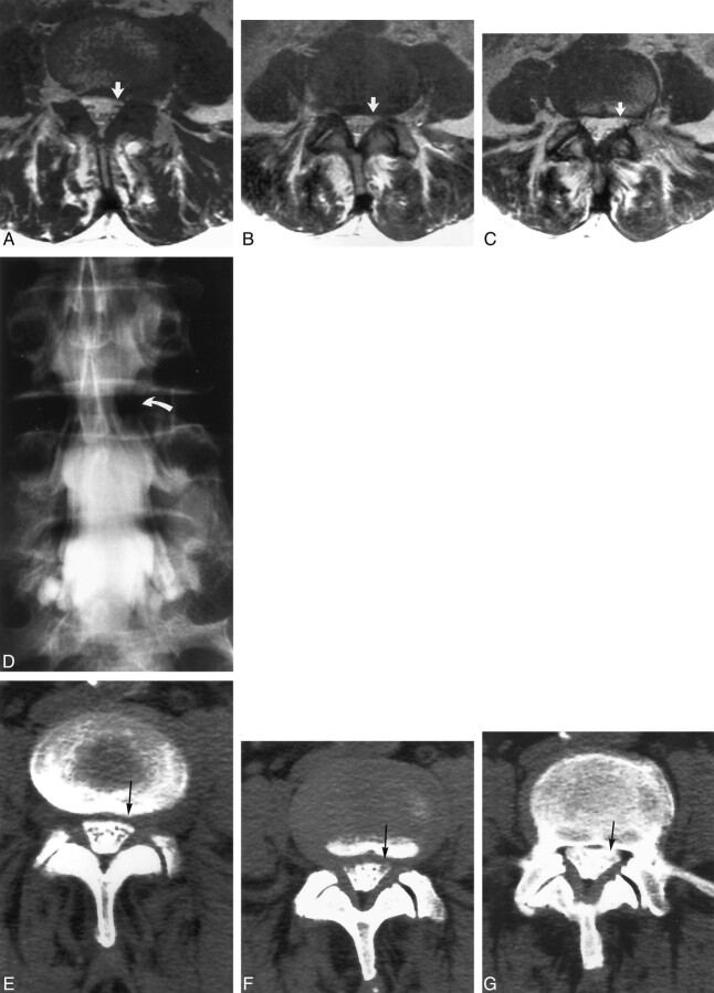 Fig 3.