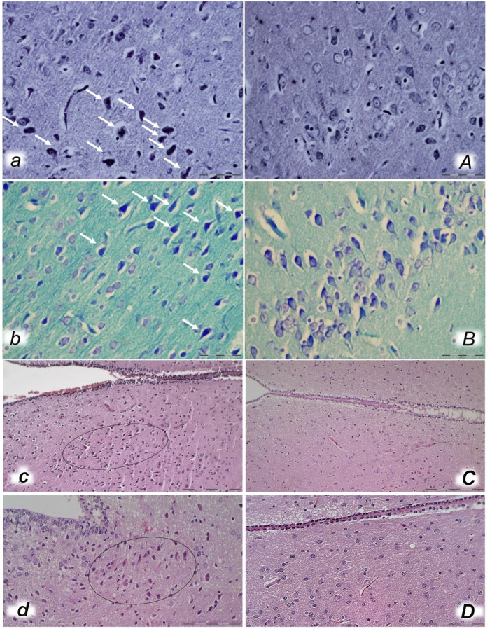 FIGURE 14