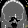 Fig. 1