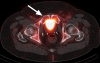 Figure 5d: