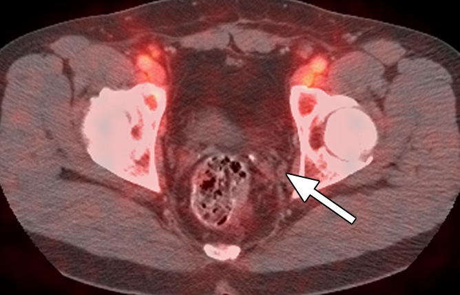 Figure 4d: