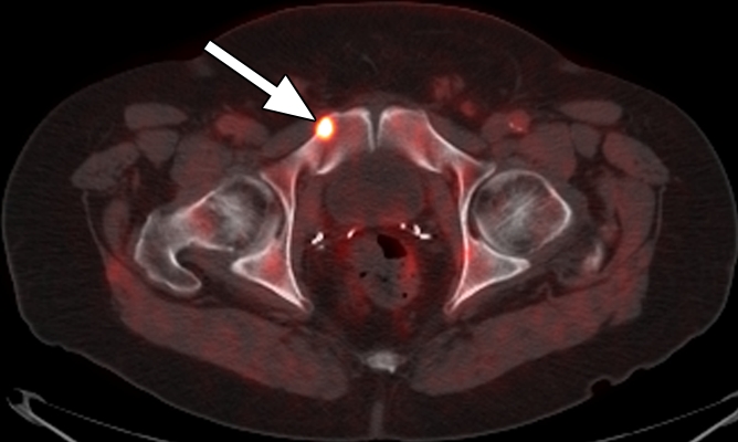 Figure 5b: