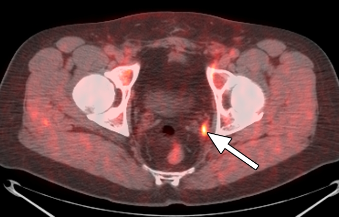 Figure 4b: