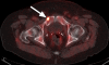Figure 5b: