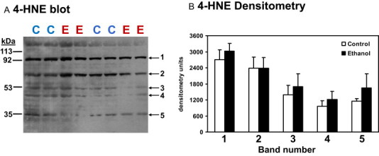 Fig 1