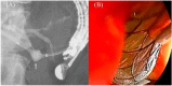 Figure 21