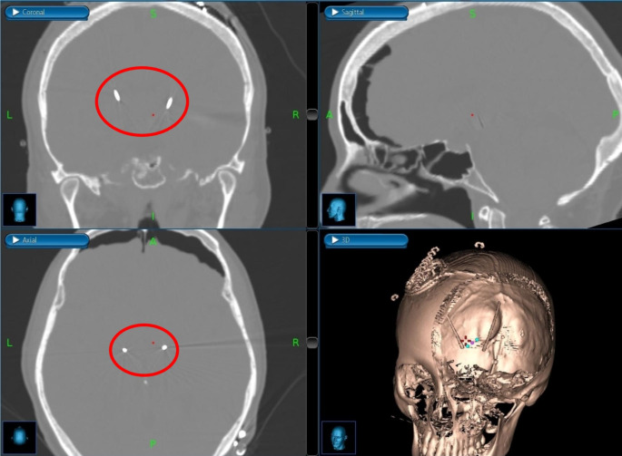 Fig. 4