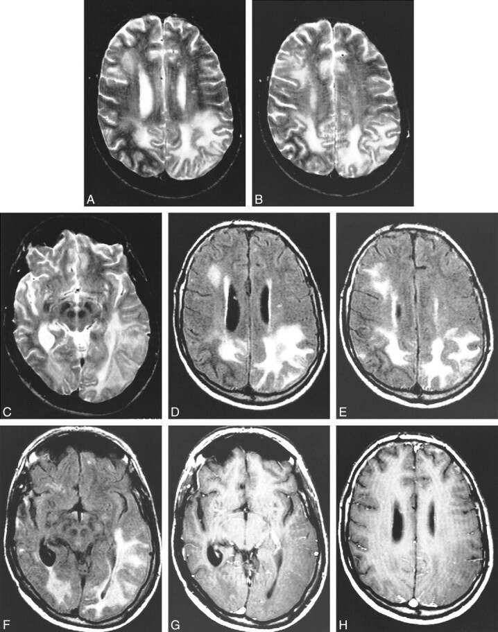 fig 3.