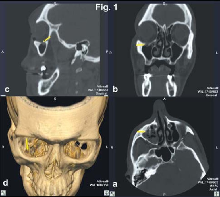 FIGURE 1