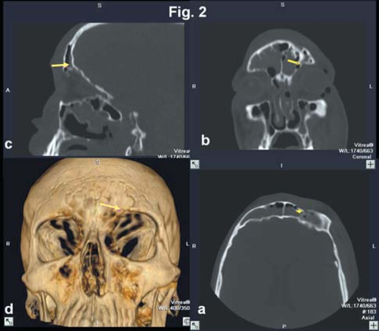 FIGURE 2