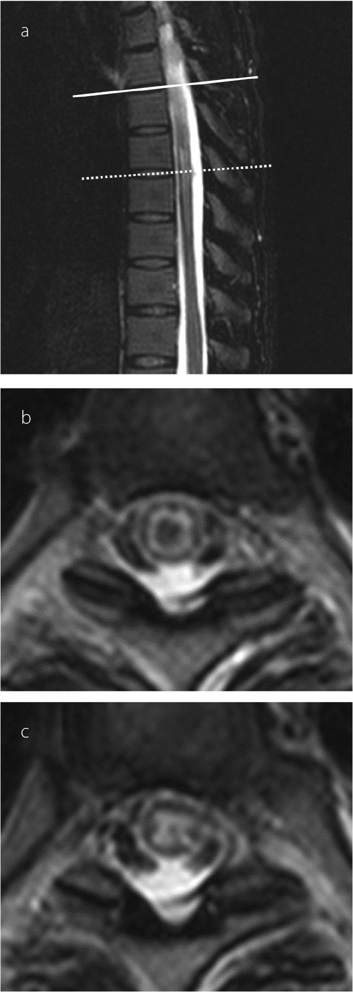 Figure 2 a–c