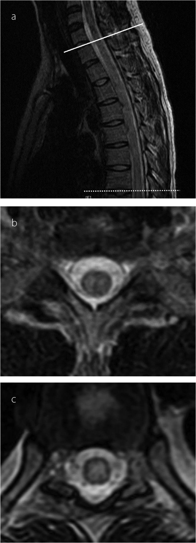 Figure 1 a–c