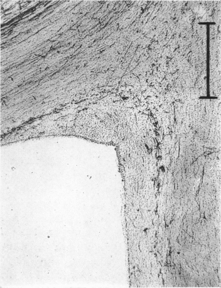 Fig. 43