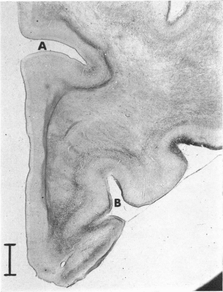 Fig. 31