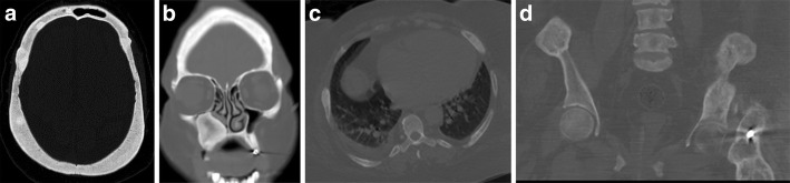 Fig. 11