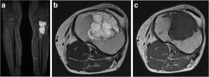 Fig. 17