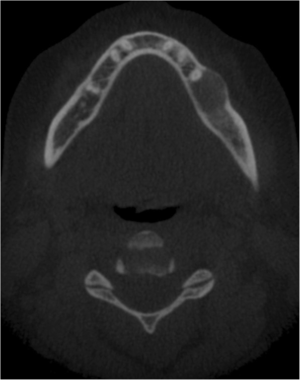 Fig. 3