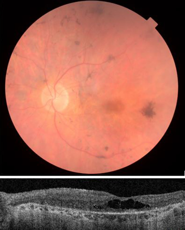 Fig. 1