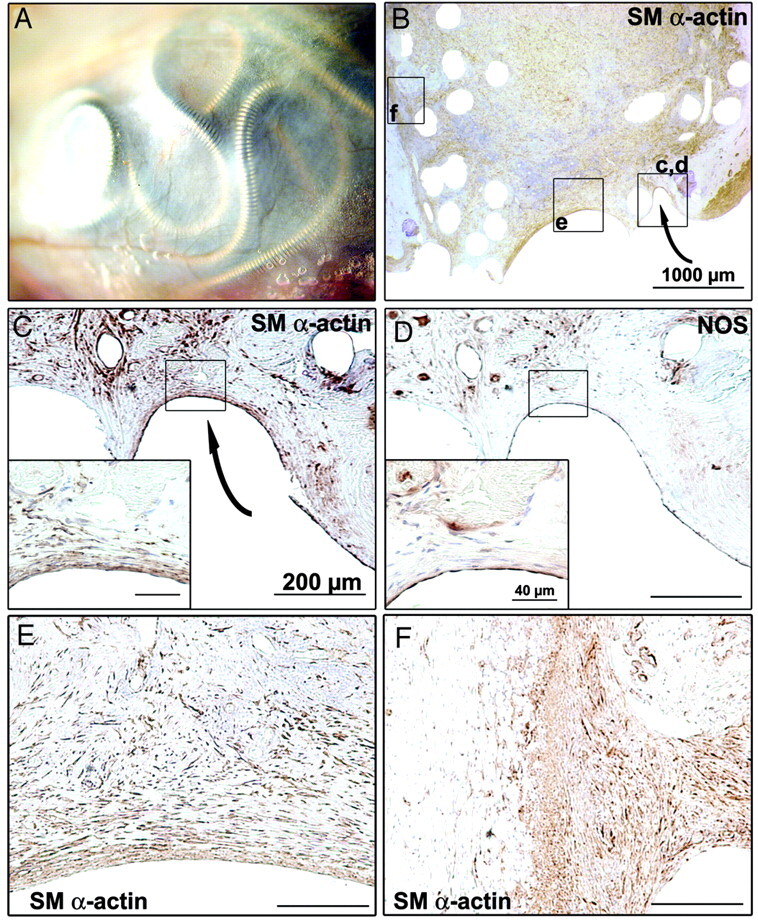 Fig 3.