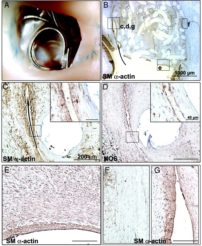 Fig 4.