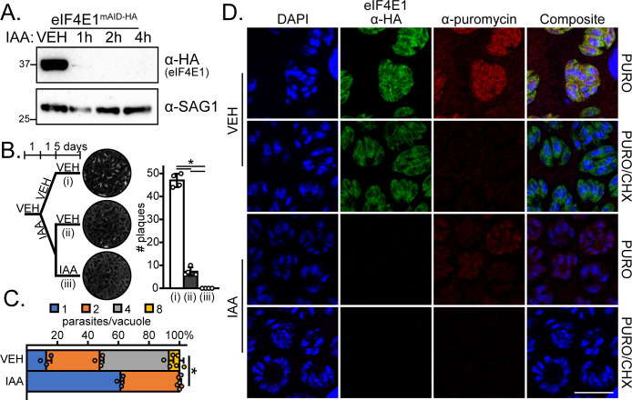 Molecular biology experiments depicts Western blot of eIF4E1 degradation, Plaque assay for parasite infection, bar graph of parasite load, fluorescence microscopy of eIF4E1 localization and translation activity under different treatments.