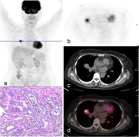 Fig. 1