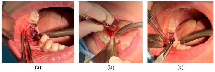 Figure 11