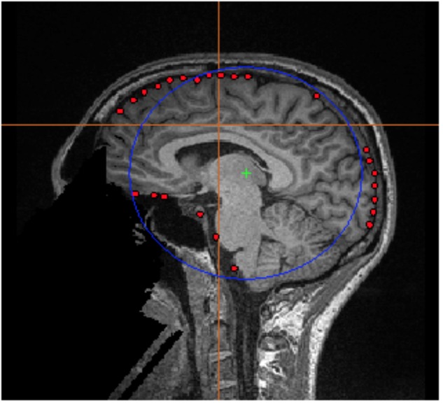 FIGURE 3