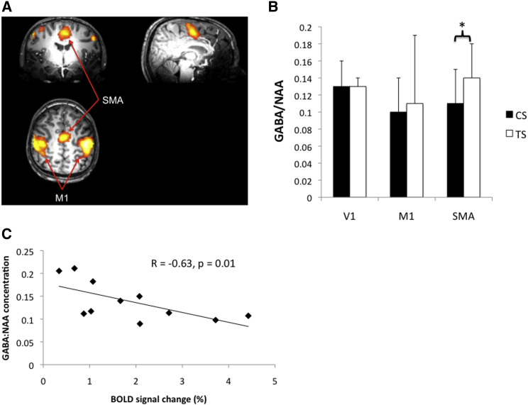 Figure 1