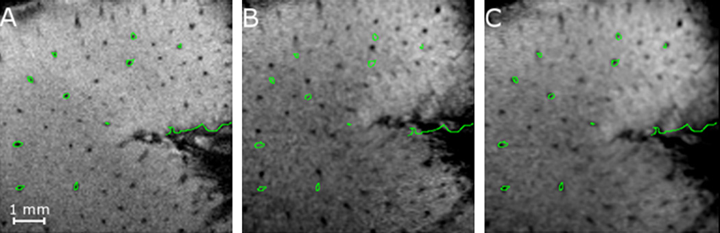 Fig. 11