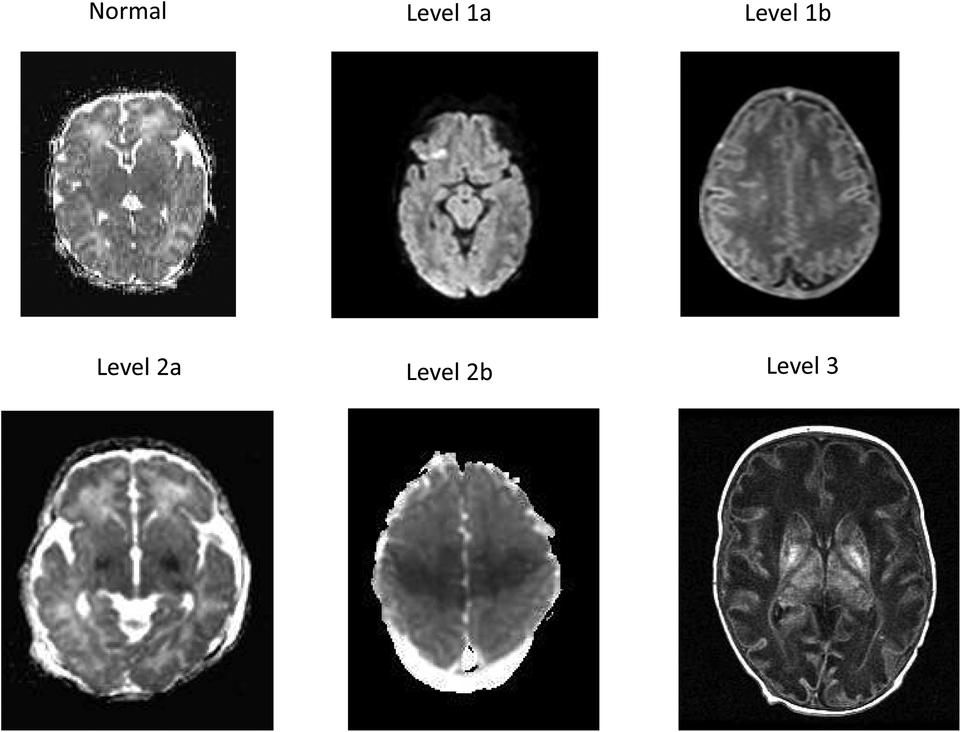 Figure 1: