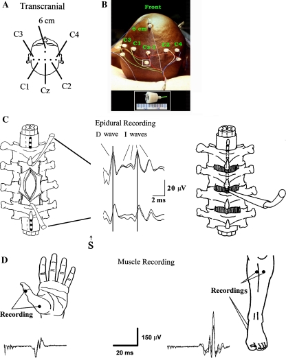 Fig. 1