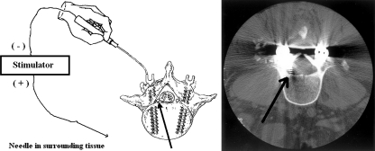 Fig. 2